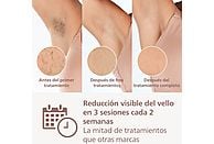 Depiladora de Luz Pulsada (IPL) Philips Lumea Serie 9000 (BRI958/00) - Electrodomésticos Idea SL