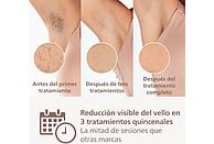 Depiladora de Luz Pulsada (IPL) Philips Lumea Serie 8000 (BRI945/00) - Electrodomésticos Idea SL